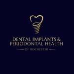 DENTAL IMPLANTS And PERIODONTAL HEALTH Profile Picture